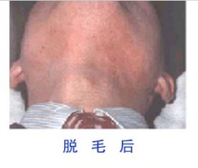 胡须后.jpg