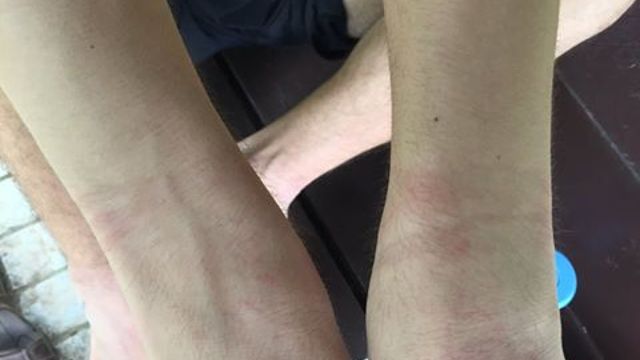 20160509-sg-autistic.jpg
