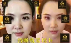 变形计---如何快速打造网红美女明星面孔和身材